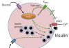 What is Diabetes