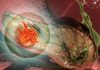 Alfa Cytology Launches Full-Scale Preclinical Services for Pancreatic Cancer Research