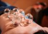 Cupping Therapy in Mumbai: A Blend of Tradition and Modernity