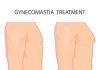 Best Gynecomastia Surgery in Delhi: Achieve Your Desired Result